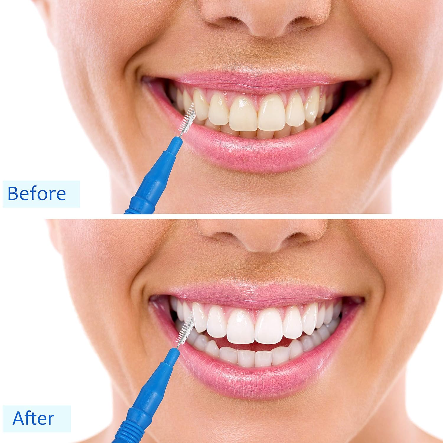100 Pcs Braces Dental Brush Flosser for Cleaner Interdental Brush Toothpick Tooth Flossing Head Oral Dental Toothpick Cleaners Cleaning Tool(Red and Blue) - Image 7
