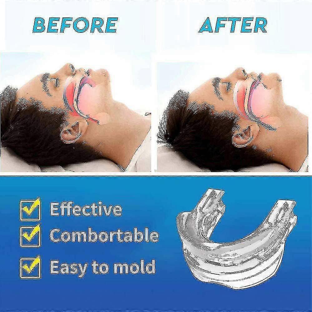 Adjustable Anti Snoring Mouthpiece Guard Anti Snore Sleep Apnea Teeth Grind - Image 3