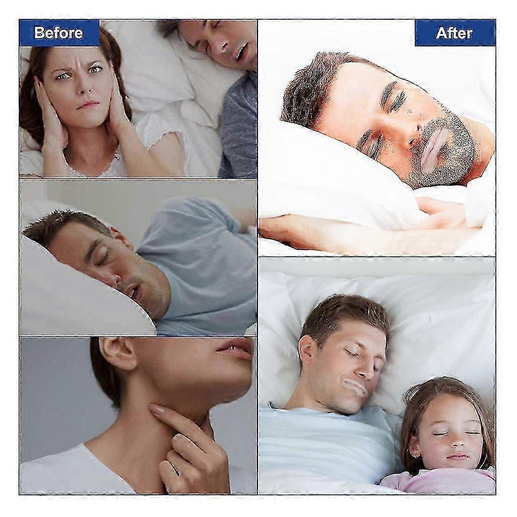 Sleep Strips Mouth Tape For Better Breathing Relief - Image 3