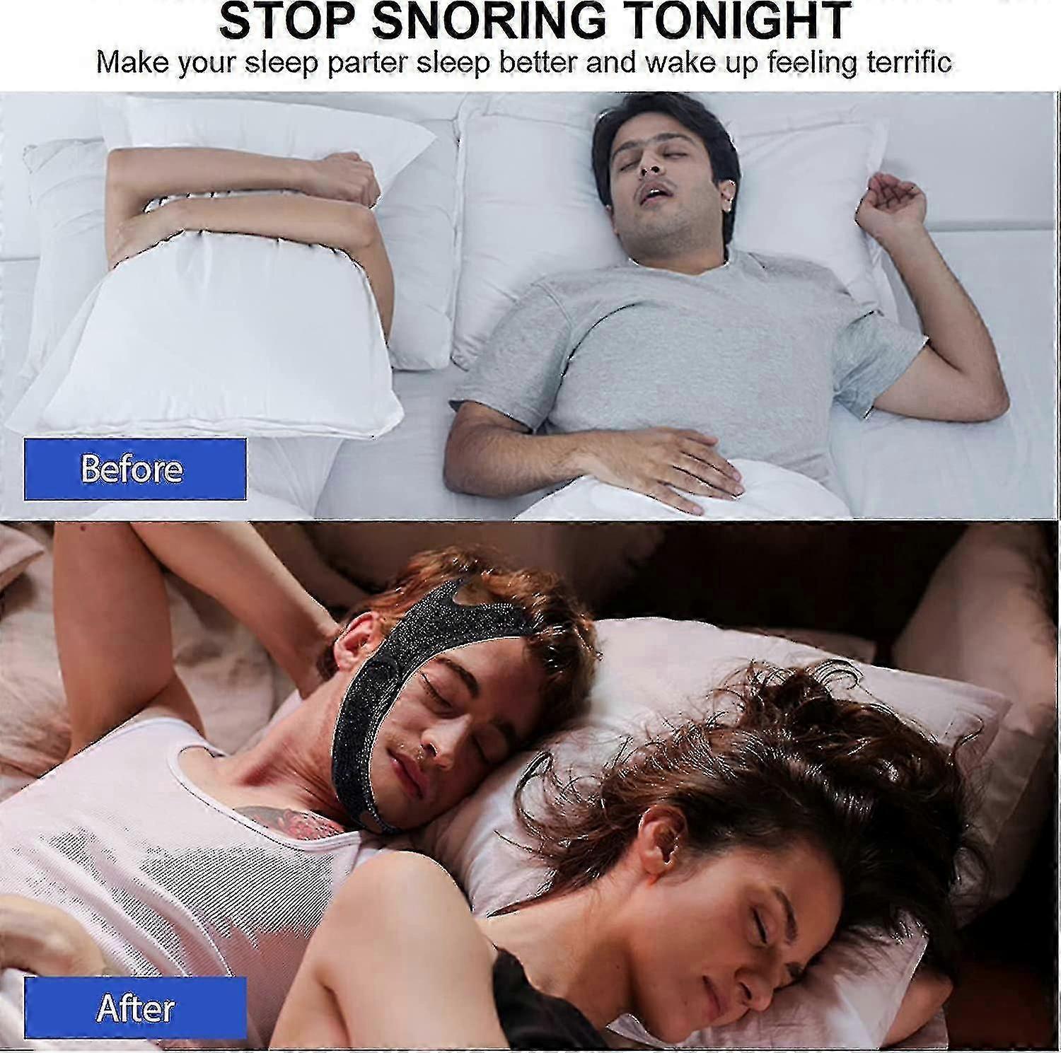Anti Snoring Chin Strap, Upgrade Stop Snore Chin Strap, Snoring Solution Snore Stopper, Professional Effective Anti Snore Devices Stop Snoring Sleep - Image 2