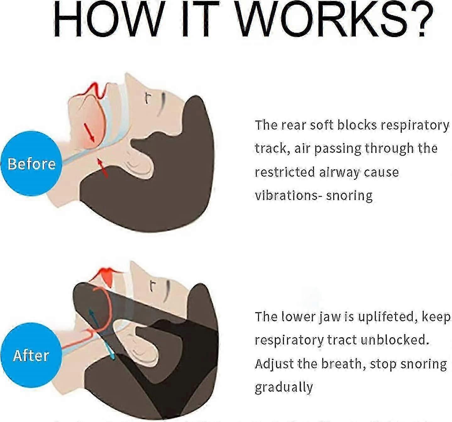 Anti Snoring Chin Strap, Upgrade Stop Snore Chin Strap, Snoring Solution Snore Stopper, Professional Effective Anti Snore Devices Stop Snoring Sleep - Image 5
