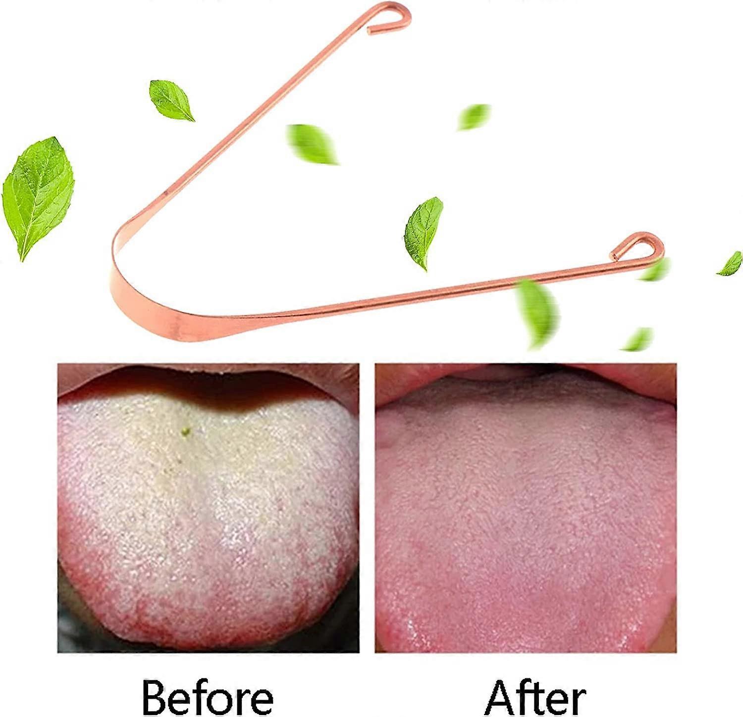 Pure Copper Tongue Scraper, Metal Tongue Cleaner for Fresh Breath & Oral Hygiene - Image 3