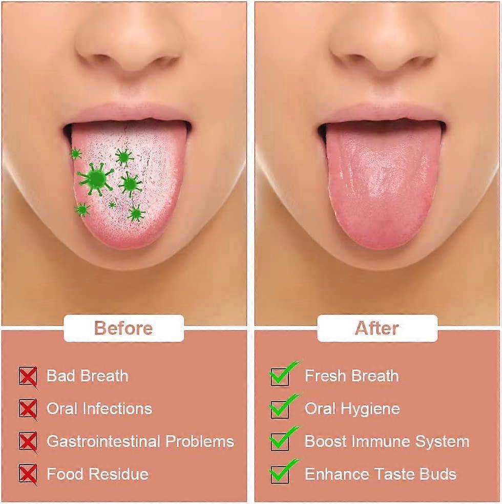2PCS Stainless Steel Tongue Scrapers, Tongue Cleaner for Bad Breath - Silver - Image 3