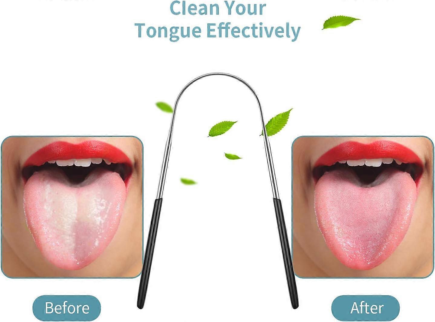 4PCS Stainless Steel Tongue Scrapers, Metal Oral Cleaner for Bad Breath - Family Pack - Image 3