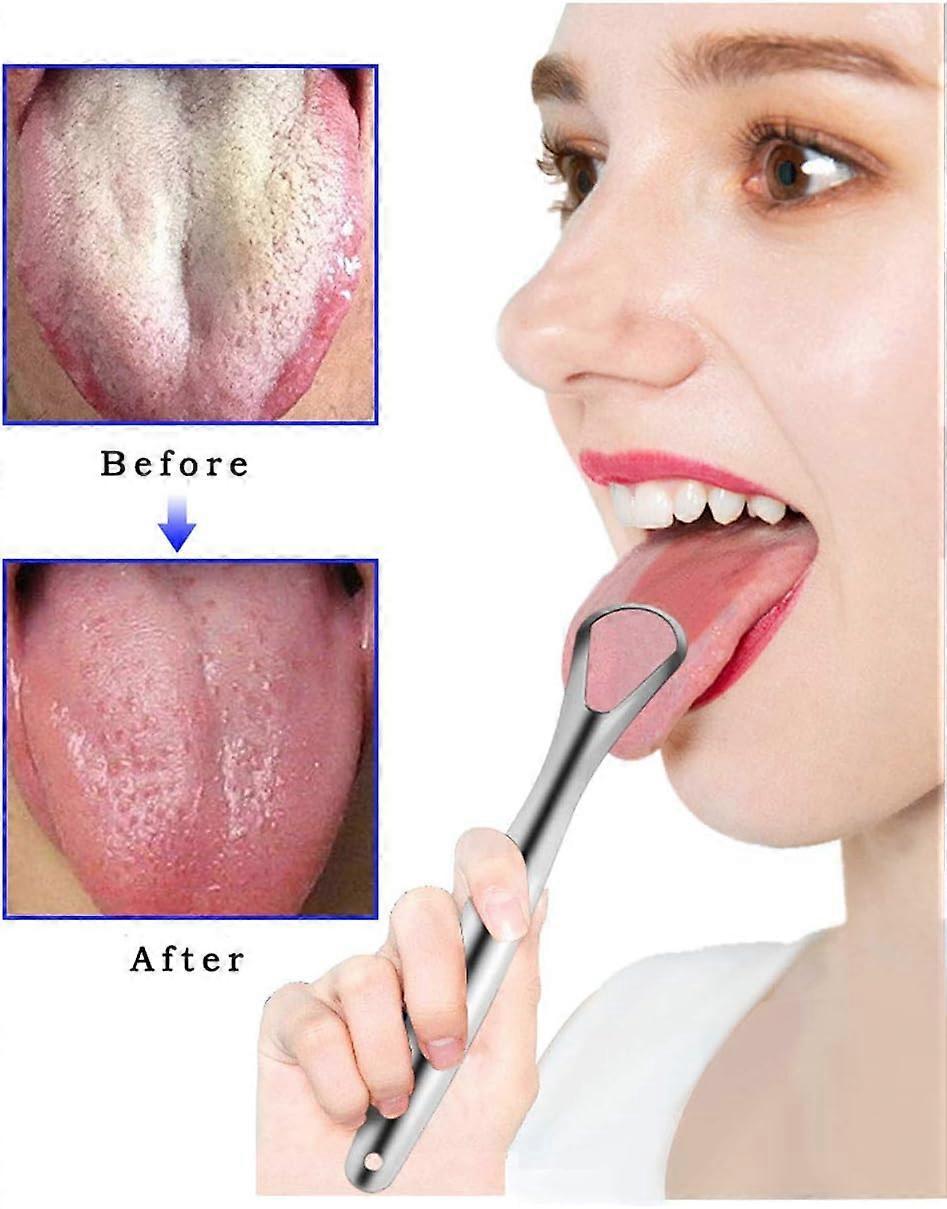 3PCS Practical Stainless Tongue Scrapers, Metal Tongue Cleaner for Oral Hygiene - Image 5