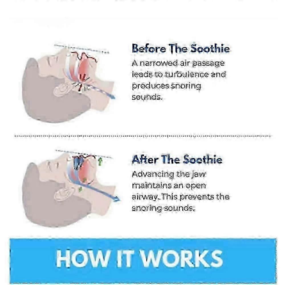 Honex Anti-Snoring Mouthpiece - Quite Night Device, Adjustable Jaw - Image 5