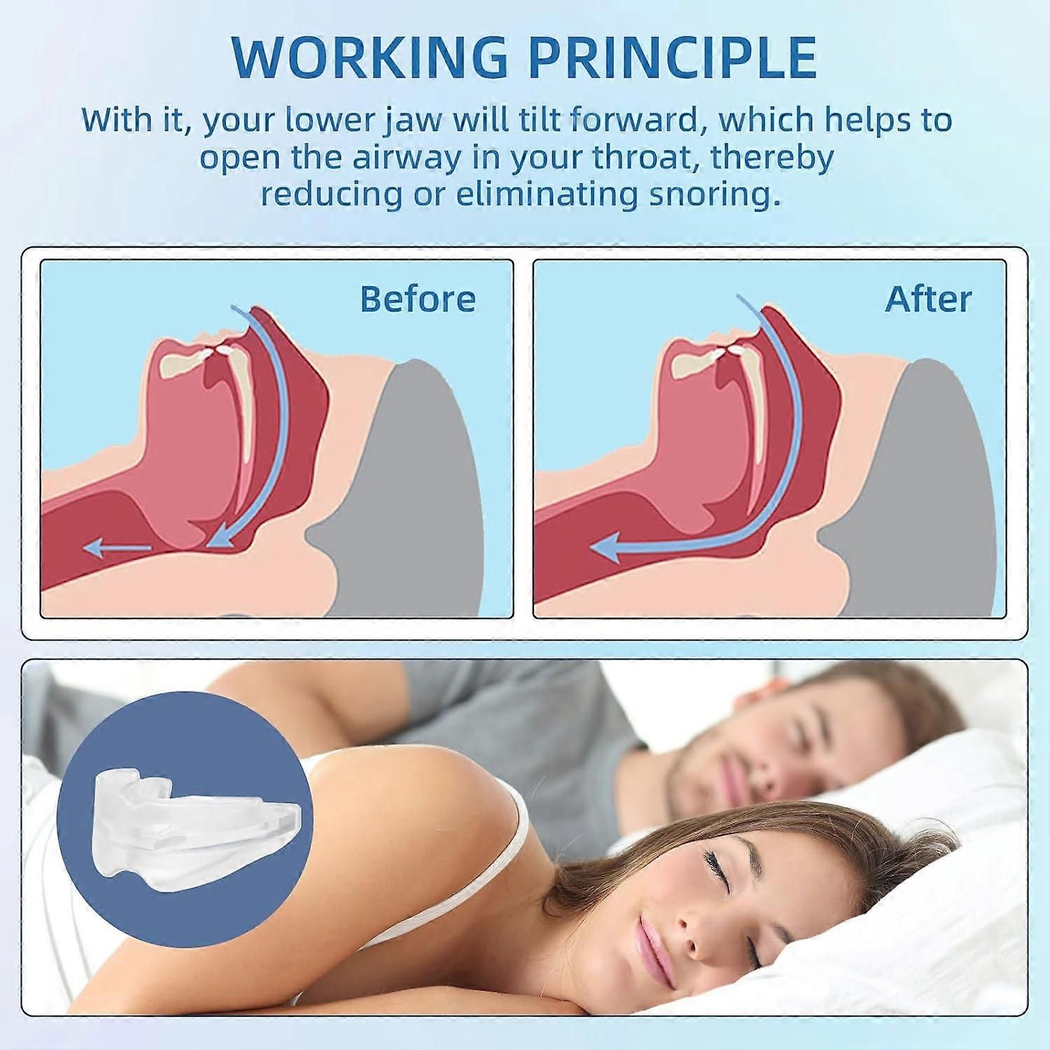 Anti-Snoring Mouthpiece - Reusable, FDA-Cleared, with Case - Image 4