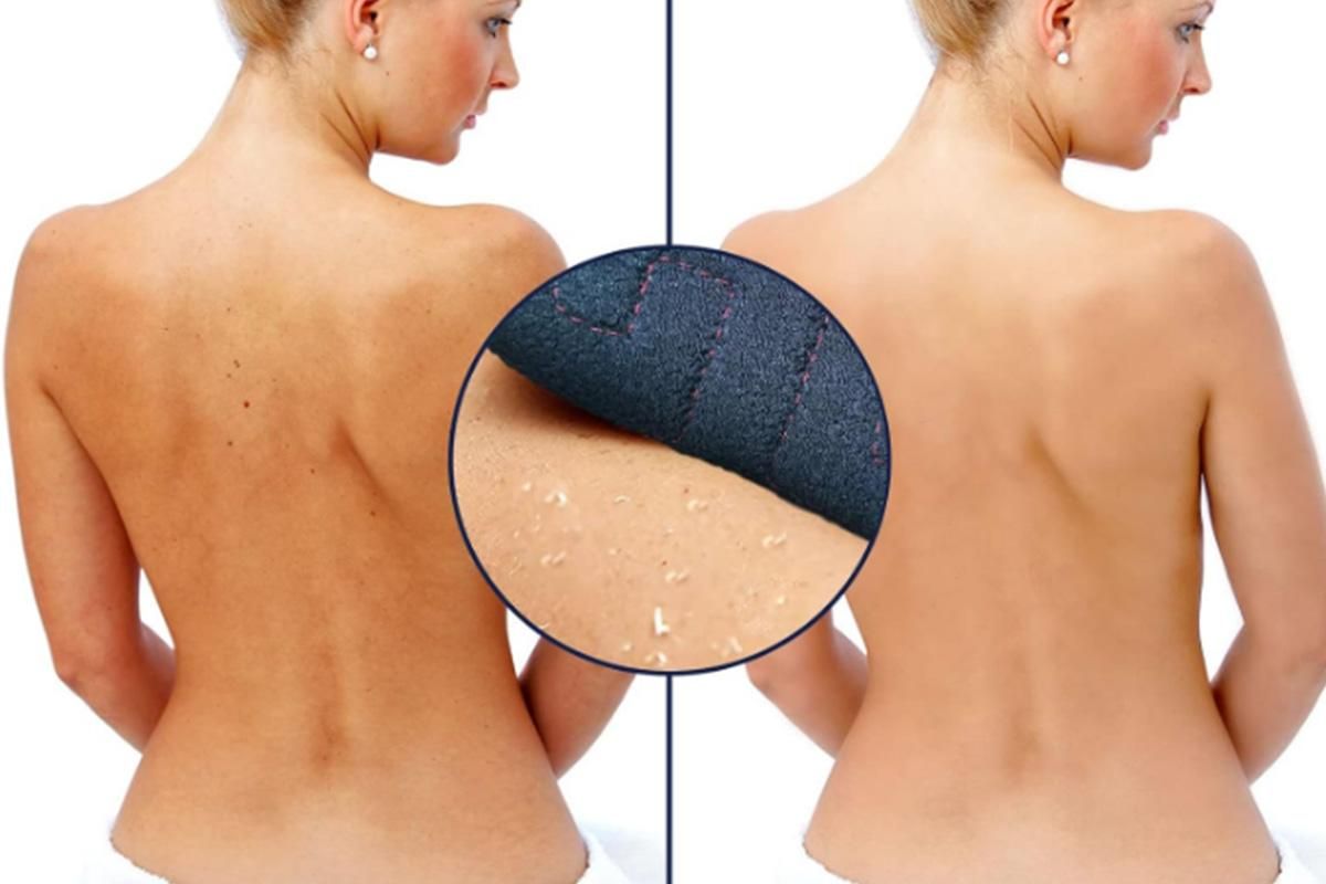 Bath Shower Exfoliating Back Strap Double-Sided Back Scrub Towel - Image 5