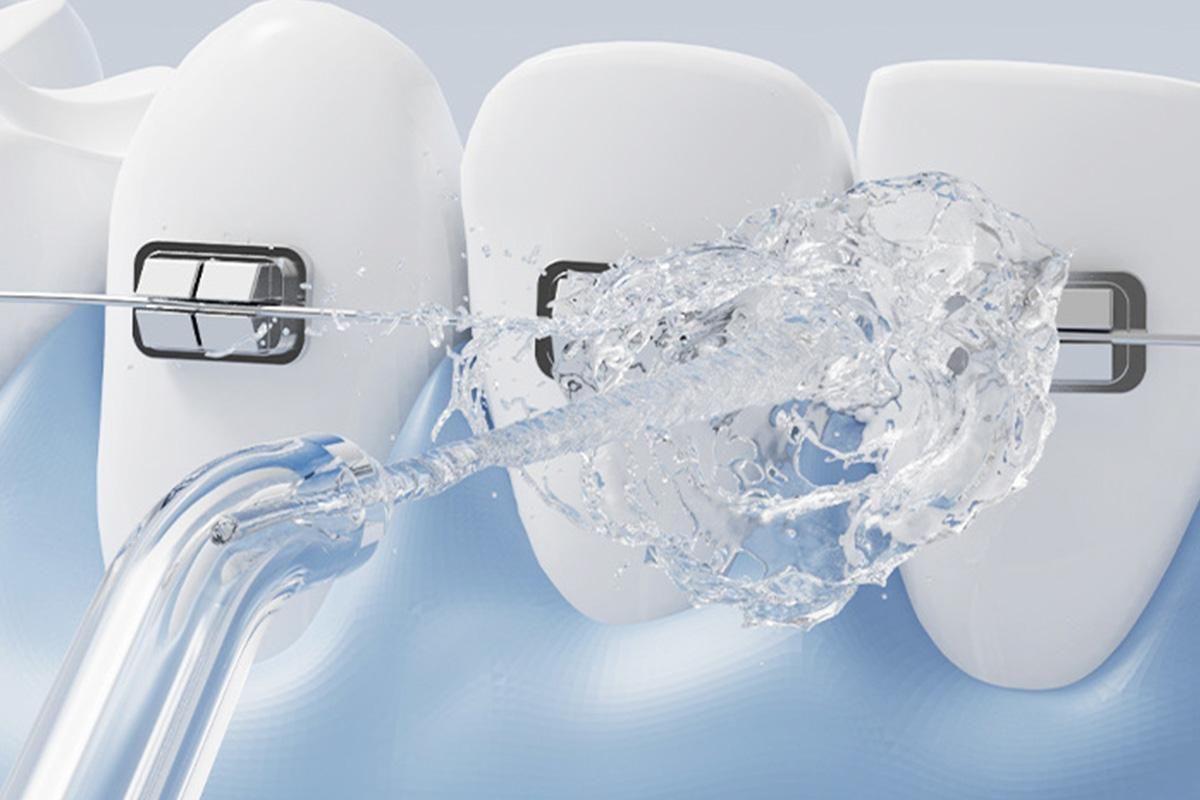 Portable Cordless Water Flosser for Teeth Deep Cleaning - Image 4