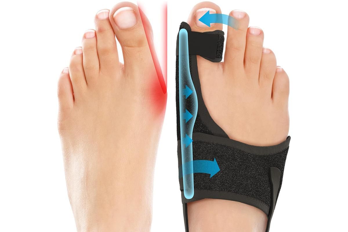 1 Pair Bunion Corrector Adjustable Length Orthopedic Toe Separator for Men and Women - Image 4