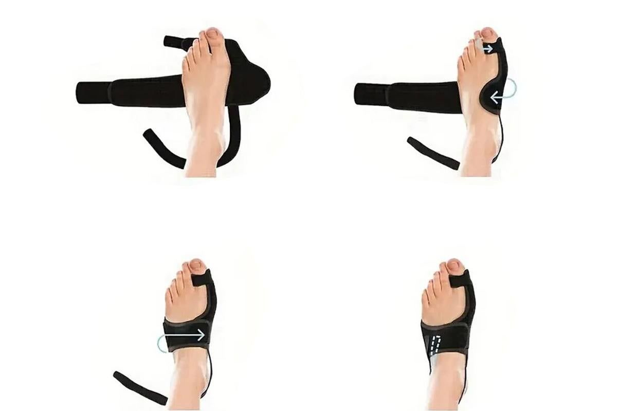 1 Pair Bunion Corrector Adjustable Length Orthopedic Toe Separator for Men and Women - Image 5