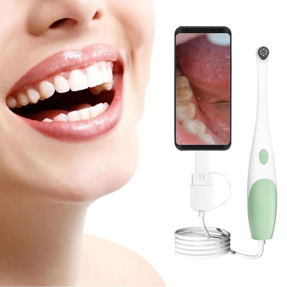 1080P Intraoral Camera Oral Endoscope Digital Imaging Intra Oral Camera - Image 1