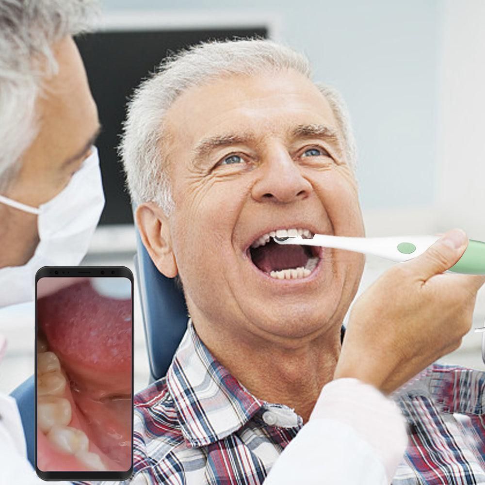 1080P Intraoral Camera Oral Endoscope Digital Imaging Intra Oral Camera - Image 3
