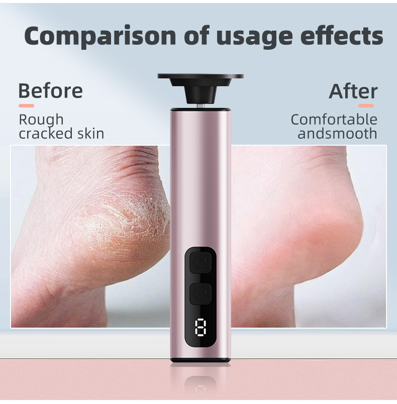Grey Professional 2-in-1 Electric Foot Callus Remover and Manicure Kit - 9 Speeds Rechargeable Electronic Foot File with LCD Display - Professional Pedicure Tool for Dead Skin and Nail Care - Image 8