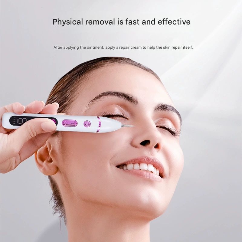 Professional Electric Mole & Dark Spot Remover Pen - Advanced Plasma Ion Technology for Seamless Skin Tag & Freckle Removal (Gold) - Image 2