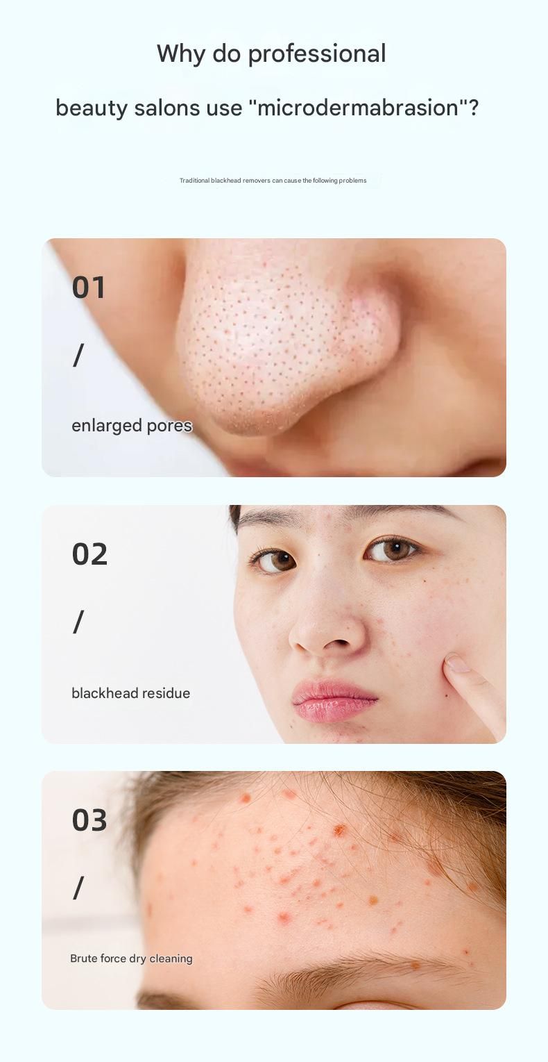 White Heated Micro-Bubble Blackhead Remover Vacuum Pore Cleaner - 46C Hot Compress Electric Water Cycle Facial Cleansing Device with 6 Suction Heads 3 Modes - Image 4